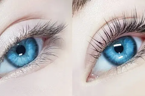 Przed i po zabiegu. Po lewej nieudana laminacja rzęs, po prawej efekt wow!