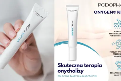 Krem ONYGEN® do regeneracji paznokci dłoni i stóp, polecany w terapii onycholizy.
