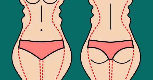 Przed i po zabiegu liposukcja ud. Dwie sylwetki, jedna z zaznaczonymi obszarami do odsysania tłuszczu, druga po zabiegu.